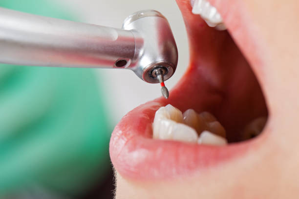 Best Emergency Dental Care for Trauma or Injury in Norton, VA